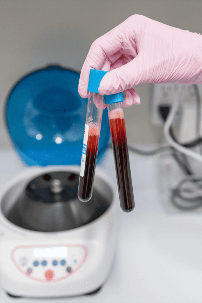 Blood Testing Tube | gfacemd | wellesley, MA