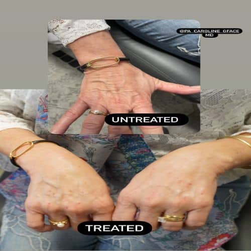 Untreated and Treated | gfacemd | Wellesley