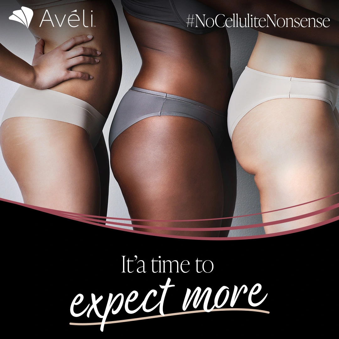 Aveli Cellulite Treatment at GFaceMD