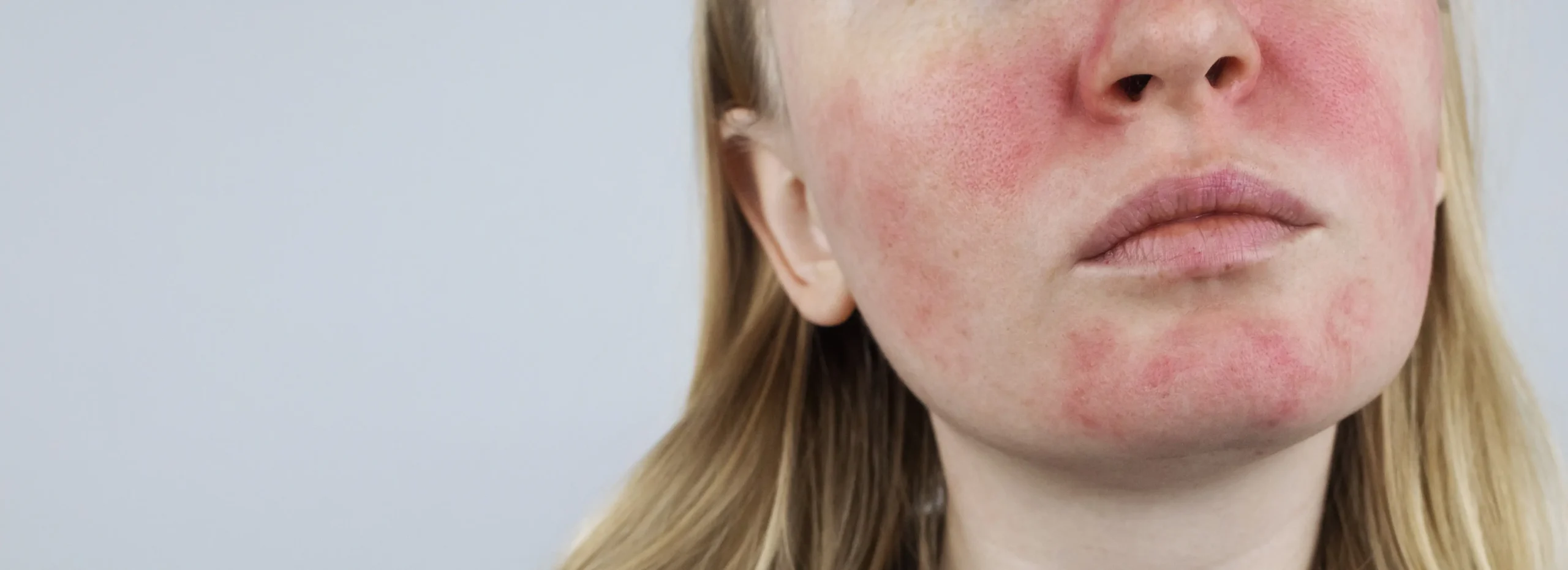 The Red Flag- Understanding Skin Redness and Product Effectiveness